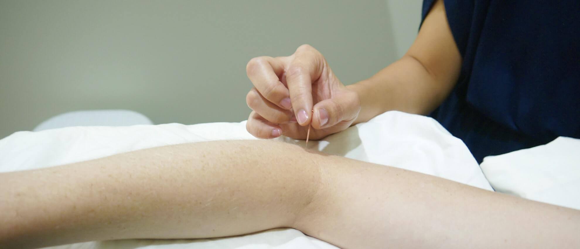 acupuncture vs physiotherapy