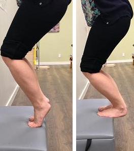 ballet dancer achilles tendonitis