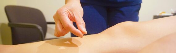 Acupuncture For Chronic Pain Relief In Burnaby